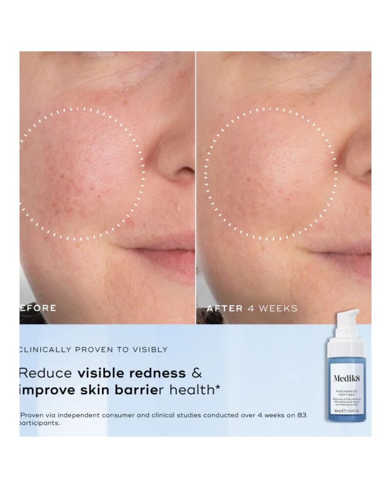 Niacynamide Peptides - serum z 10% niacynamidem 30 ml - obrazek 2