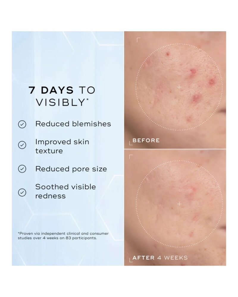 Niacynamide Peptides - serum z 10% niacynamidem 30 ml - obrazek 3